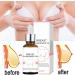 Natural Breast Enlargement Oil - 20ml Firming & Lifting Essential Oil for Women | Boost Plumpness & Confidence - Buy Online on GoSupps.com