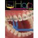 Harp Orthodontic Reusable Flosser - Easy and Effective Dental Flossing Tool - Buy Online on GoSupps.com
