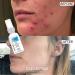 CLEARstem CellRenew Facial Serum | Stem Cells & Hyaluronic Acid | 1 Oz - Buy Online on GoSupps.com