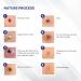 Mole Removal & Skin Tag Repair Gel Set - Remove Effectively at Home - Buy Online on GoSupps.com