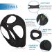 Anti Snoring Chin Strap - Adjustable, Comfortable, Professional Stop Snoring Device for Men, Women, and Kids - Black 1pc - Buy Online on GoSupps.com