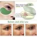 AICHUN BEAUTY Avocado Collagen Eye Mask Patch - Hydrating Anti-Wrinkle Treatment - Buy Online on GoSupps.com