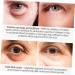  POPETPOP POPETPOP Anti-Alligator Essence Eye Contour Cream - Wrinkle and Puffiness Reduction - Moisturizing - Buy Online on GoSupps.com