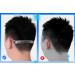 Buy Zhongjiuyuan 200 Pcs Adjustable Ear Hooks & Straps - Hearing Protection Belt to Prevent Earache | International Shipping Available - Buy Online on GoSupps.com