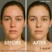 Lopren Niacinamide Active Ingredient Set Hyaluronic Acid & Collagen Anti-Aging Serum Niacinamide & Hyaluronic Acid Cream Hydration Wrinkle Reduction Acne Treatment Pore Minimizer - Buy Online on GoSupps.com