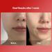 Buy MEDITHERAPY Shumage Gold Seal Wrapping Mask - 82.5% Collagen Overnight Peel Off Mask for Revitalizing & Tightening | Korean Skin Care | International Shipping - Buy Online on GoSupps.com
