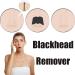 80 Pieces Remove Impurities Unclogs Pores Blackhead Remover Strips Draws Out Dirt and Excess Oil Nose Pore Strips Nose Pore Strips Nose Strips Blackhead Deep Cleansing for Men & Women (Black) - Buy Online on GoSupps.com