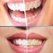Miyanxi Tooth Powder - Effective Whitening for Coffee & Smoke Stains | 50g Box | International Shipping - Buy Online on GoSupps.com