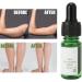 10 ml Anti-Cellulite Massage Oil - Essential Plant Extract for Belly Fat Burning & Slimming | Tighten Stomach Legs & Arms - Buy Online on GoSupps.com