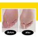 PediVac Electric Callus Remover with Built-In Vacuum - New Look | Removes Calluses & Dry Skin in Seconds | Mess-Free | 2000 RPMs | LED Light | 2 Speed Settings - Buy Online on GoSupps.com