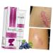 PLAFOPE Scar Cream - Scar Eraser & Remover for Face, Stretch Marks, Skin Repair - 1pc - Buy Online on GoSupps.com