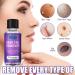 LDREAMAM Skin Tag Removal Gel - Safe & Effective Mole & Wart Remover - Buy Online on GoSupps.com