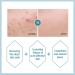 Buy Pyunkang Yul Acne Toner 150ml - Effective Acne Treatment - Buy Online on GoSupps.com