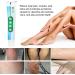 Varicose Veins Cream & Ointment for Relief | Phlebitis Angiitis & Inflammation Treatment - Buy Online on GoSupps.com