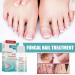 Mify 10ml Nail Fungus Treatment | Nail & Toenail Care Liquid | Fast-Acting Foot Care Solution - Buy Online on GoSupps.com