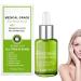 30ml Goopgen Advanced Scar Repair Serum Goopgen Scar Repair Scar Removal Cream Scar Removal Medical Grade Spray Scar Treatment Serum For All Types of Scars (1PCS)