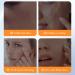 Whitening Niacinamide Serum - Face Serum for Women - Hyaluronic Acid Serum for Face - Skin Care for Dark Spot Correcting Glow Serum - Face Serum for Anti-Ageing and Wrinkles (30ml) - Buy Online on GoSupps.com