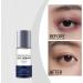 S rum hydratant et claircissant pour les yeux l'acide hyaluronique traitement anti- ge pour les yeux cr me anti-rides pour les cernes poches et poches sous les yeux r duit les ridules (6PCS) - Buy Online on GoSupps.com
