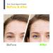 Tea Tree Spot Patch 90 Dots with Salicylic Acid for Acne Blemishes - Invisible Bandaids for Covering Pimples - Face Stickers for Blemish Control - 0.55 Inch Patches - Buy Online on GoSupps.com