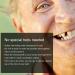 Filling Material for Temporary Broken Teeth Repair - 50g - Buy Online on GoSupps.com