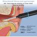 Rememower Otoscope 1080p HD Ear Wax Removal Tool - Waterproof Ear Cleaner for iPhone iPad & Android - Ultrad nne Design with 3.5mm Lens & U6 LEDs - Glossy Black - Buy Online on GoSupps.com