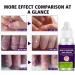 Nail Repair Toenail Care Solution Multi-purpose Renewl Restores Discolored and Damaged Nails 10 ML cracked nail repair gel - Buy Online on GoSupps.com