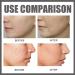 Face Moisturiser - Soothing & Barrier Support Serum Barrier Serum Skin Barrier Repair Cream Tightening Serum Serum Face Anti Redness Serum Facial Serum Face Moisturiser Serum Face Skincare Serum - Buy Online on GoSupps.com