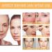Glycolic Acid 7% Toning Resurfacing Solution -Glycolic Acid 7% Toning Resurfacing Solution for Blemishes and Acne Anti-Aging Freckle Removal Acne Tighten Pores 2bottles - Buy Online on GoSupps.com