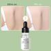 Effective Slimming Oil - Fat Burner for Abdominal and Stomach Fat | Anti-Cellulite Body Oil | 15 ml - Idezek - Buy Online on GoSupps.com