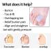 Sumiwish 10x Hallux Toe Spreader - Silicone Hallux Correction for Overturned & Hammer Toes - Pain Relief Toe Separator - Stiff Design - International Shipping - Buy Online on GoSupps.com