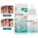 Bright Nail Repair | Best Toenail Fungus Treatment | 10 mL - Fast & Effective Infection Relief - Buy Online on GoSupps.com