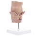 iplusmile Pathological Hemorrhoid Medical Model Teaching Medical Hemorrhoid Model
