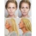 Fils de Soie de collag ne pour Fil de Soie Lifting de Fil de Soie pour Le resserrement de la Peau collag ne Actif pour Le Visage Fils de Soie Lifting et renforcent efficacement la Peau du Visage - Buy Online on GoSupps.com