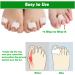 Gel Toe Separators for Bunions & Overlapping Toes - 8 Pack Hammer Toe Straightener, Pinky Toe Spacers, Bunion Corrector & Relief - White - Buy Online on GoSupps.com