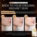 24K Mucin Snail Essence Snail Mucin Serum Face Moisturiser with Hyaluronic Acid Serum Niacinamide Serum Ginseng Extract Skincare for Hydrating Anti-Wrinkle Even Skin Tone - Buy Online on GoSupps.com