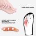 Small Toe Separator - ANGGREK 7 Pairs 3-Hole SEBS Hallux Valgus Toe Corrector Tool for Pain Relief & Skin Brightening - Buy Online on GoSupps.com