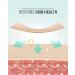 6-Pack Silicone Scar Sheets - Surgical Keloid Burn & C-Section Recovery - Reusable Medical Grade Strips for Optimal Healing - Buy Online on GoSupps.com