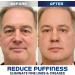 OPENEYES Awaken Peptide Eye Gel Set - Reduces Puffiness, Dark Circles, and Wrinkles (3pcs) - Buy Online on GoSupps.com