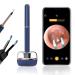 BEBIRD Ear Wax Removal Tool Fully Upgraded Flagship Model 10 Megapixel HD Ear Wax Removal with Camera Tweezer and Rod 2-in-1 Bebird Ear Cleaner WiFi Smart Ear Pick for iPhone Android Yellow