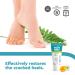 FOOTNESS Cream for Cracked Heels 25% Urea Restores Dry Skin in 7 Days (50 ml) - Buy Online Now! - Buy Online on GoSupps.com