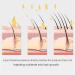 Hair Oil Applicator & Scalp Massager for Hair Growth - Essential Brush for Hair Treatment - White - Buy Online on GoSupps.com