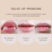 Sonew 2pcs Roll On Lip Oil Set | Moisturizing Lip Balm for Dark Lips | Unisex Lip Care Daily - Buy Online on GoSupps.com