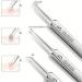 TKNIBEEN Usiveinborn Blackhead Remover Usiveinborn Professional Facial Blackhead Remover Tweezers Blackhead Tweezers Stainless Steels Blackhead Tweezers Extraction Tool (Set A) - Buy Online on GoSupps.com