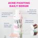SONYA DAKAR Super Clear Serum - Acne Fighting with Salicylic Acid & Niacinamide | Minimize Pores Reduce Inflammation & Blemishes | International Shipping Available - Buy Online on GoSupps.com