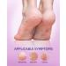 4 Pairs Foot Peel Mask Skin Exfoliating Foot Masks Cracked Feet Callus Dead Skin Remover - Feet Peeling Mask for Soft Feet Scent of Lavender (L count 4) L 4.0 - Buy Online on GoSupps.com