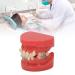 24-Teeth Ceramic Orthodontic Model with Wires & Brackets for Dental Training - International Shipping Available - Buy Online on GoSupps.com