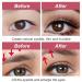 Slide Stripes Double-Sided Eyelid Tapes - 720 Invisible Adhesive Strips for Bumps & Hooded Lids - Buy Online on GoSupps.com