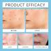 Acne Repair Face Cream - Moisturiser Face Women - Face Moisturizer for Women - Deeply Nourishes Skin - Skin Lightening Cream - Light Texture and Easy Absorption - Buy Online on GoSupps.com