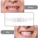 Brigtviee Teeth Veneers - Snap-in Braces for Instant Perfect Smile | DIY Temporary Fake Teeth Kit with Box (2 Pairs) - Buy Online on GoSupps.com