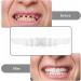 Brigtviee Instant Veneers - 2 Pair Snap-On Fake Teeth for Men & Women | Cosmetic Temporary Teeth Prostheses - Buy Online on GoSupps.com